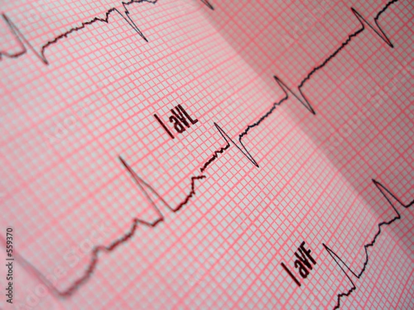 Fototapeta heart analysis scheme