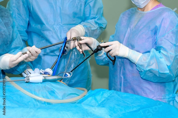 Fototapeta Hands of surgeons in sterile gloves use laparoscopic surgical instruments. A team of surgeons operates on a patient in the operating room. Selective focus.