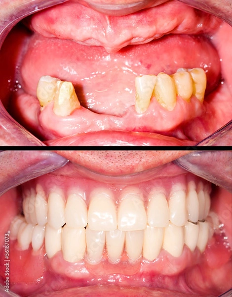 Obraz Before and after