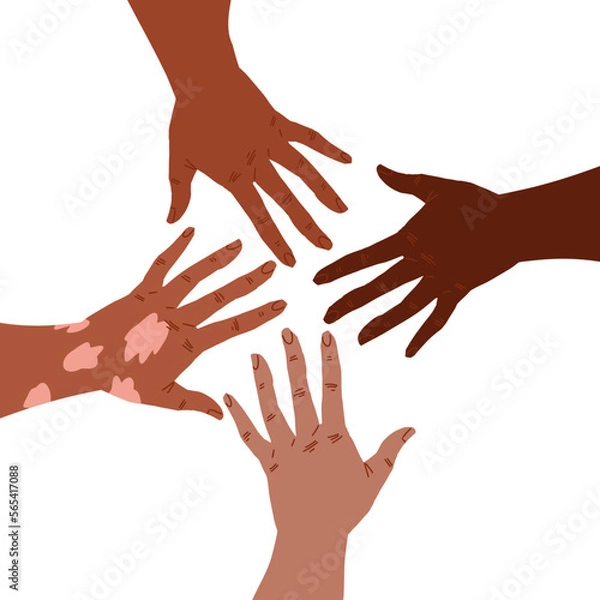 Fototapeta Group of hands reaching to each other, one hand with vitiligo patch