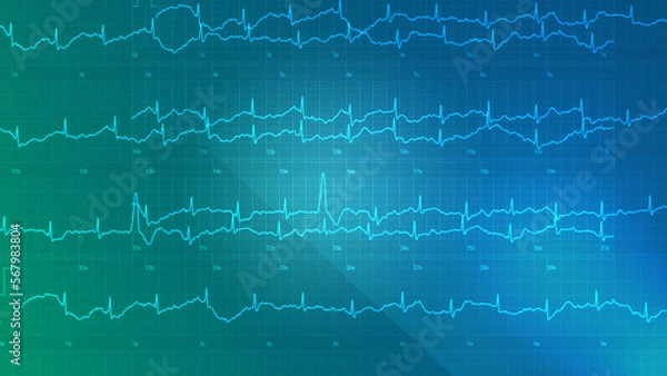 Obraz heartbeat make a heart