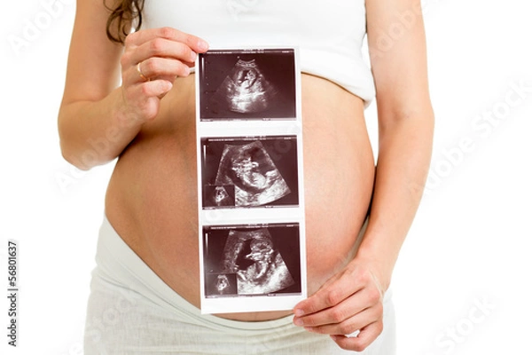 Fototapeta Kobieta w ciąży trzymająca skanowanie ultradźwięków na brzuchu