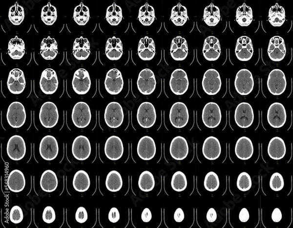 Obraz Horizontal sections of a complete human brain scan.
