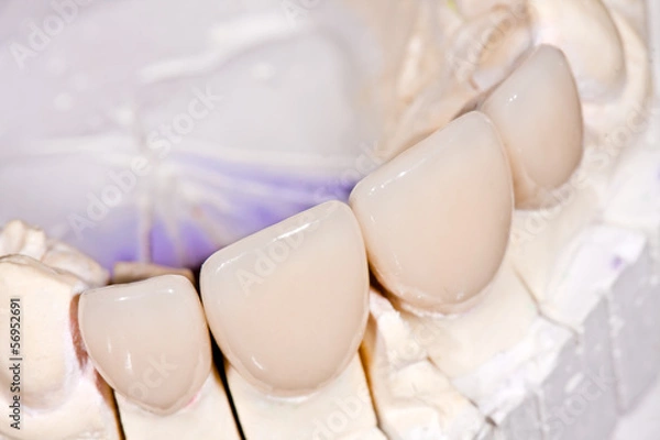 Obraz Ceramic crowns
