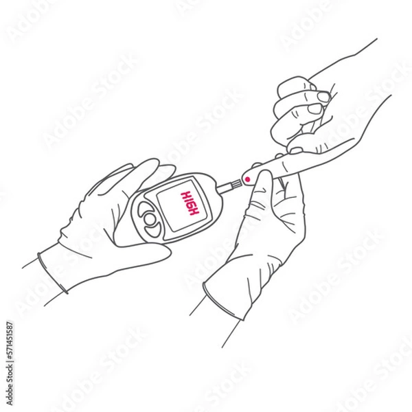Fototapeta hand of a doctor in a glove checking the patients blood sugar level with a glucometer