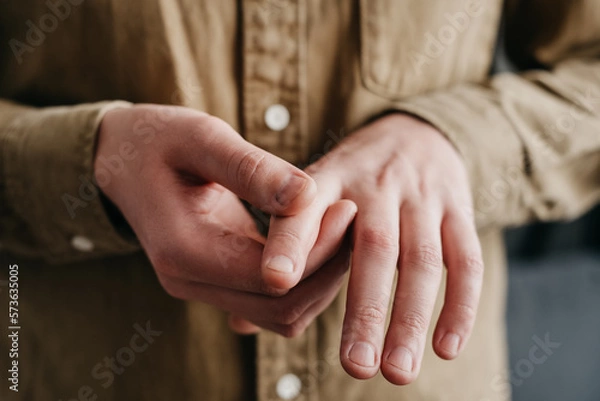 Obraz Close up of unhealthy young caucasian man suffering from arthritis in fingers. Cause of pain include rheumatoid arthritis, carpal tunnel syndrome, trigger finger or gout. Health care concept