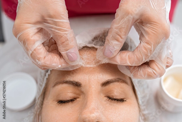 Obraz Cosmetologist applies silk threads for facelift. Non-surgical cosmetology. Skin care
