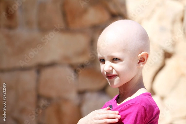 Fototapeta chemo child