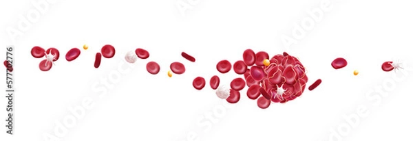 Fototapeta 3D illustration of a blood clot in a blood vessel showing a blocked blood flow with platelets and white blood cells in the image. medical use education and science