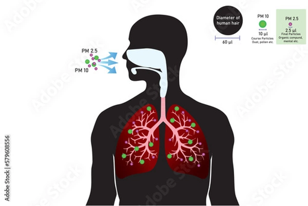 Fototapeta The impact of air pollution with PM 2.5 microns on the human lungs. 