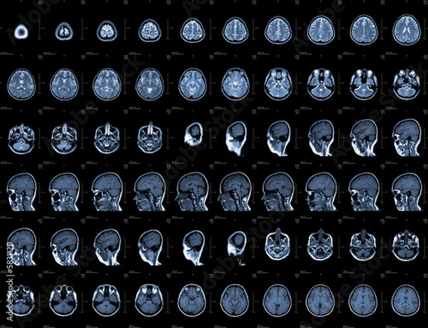 Obraz Brain and head MRI or CT images