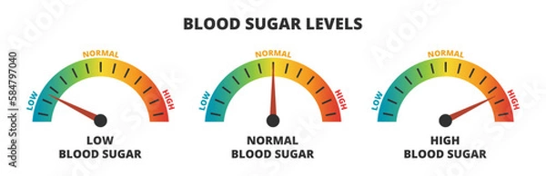 Fototapeta Vector infographic set of blood sugar levels – glucose meters with low, normal, and high level results, diabetes, prediabetes. Indicator gauge with color scale and arrow showing blood sugar levels.