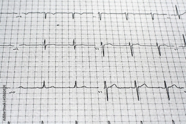 Fototapeta EKG Readout