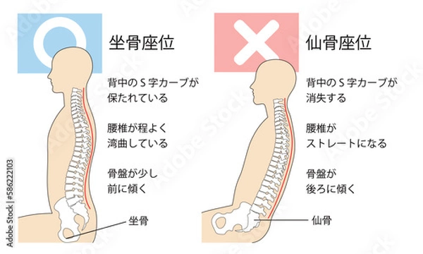 Obraz 坐骨座りと仙骨座りの比較説明イラスト