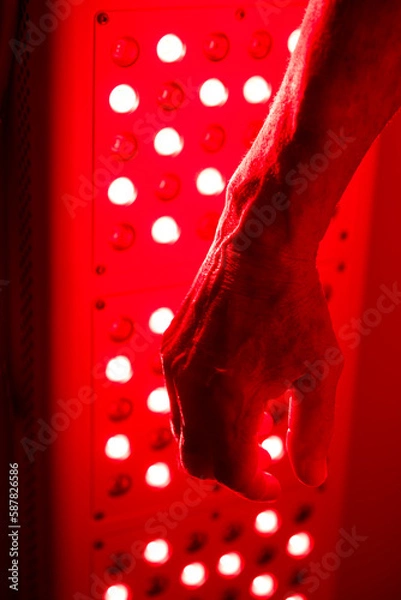 Obraz Far Infared Light Therapy on the Arm and Hand