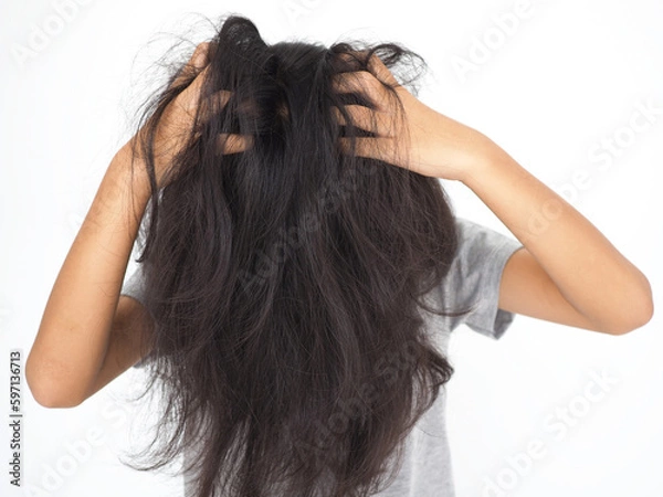 Obraz Little girl is scratching her head on white background. Closeup photo, blurred.