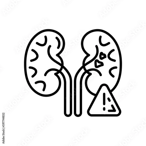 Fototapeta Organ Failure icon in vector. Illustration
