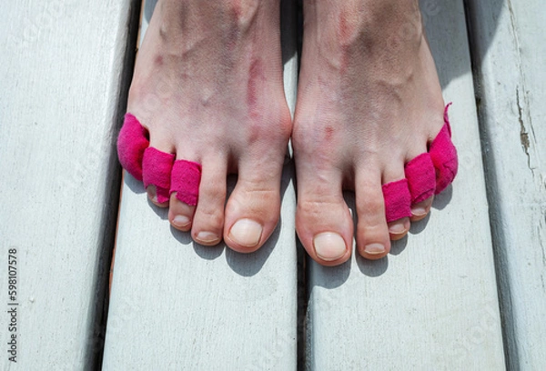 Obraz Brightly bandaged toes of a tired legs. Woman with removed shoes sitting on wooden bench, taking a break after a long day of hiking. 