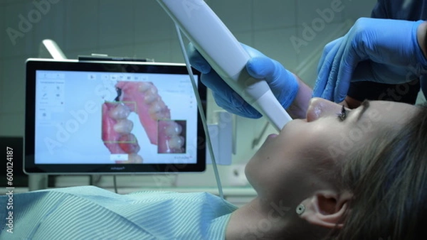 Fototapeta Doctor scans the patient's teeth in the clinic. The dentist holds in his hand a manual 3D scanner for the jaw and mouth. Dental health. Creates a 3D model of teeth and gums on a medical monitor