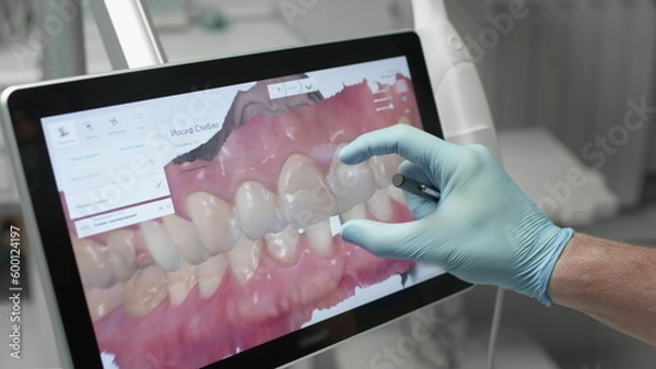 Fototapeta A professional dentist man looks at a 3d model of teeth on a computer monitor. Dental consultation, diagnostics. Jaw scan, digital imprint, medical digital technology