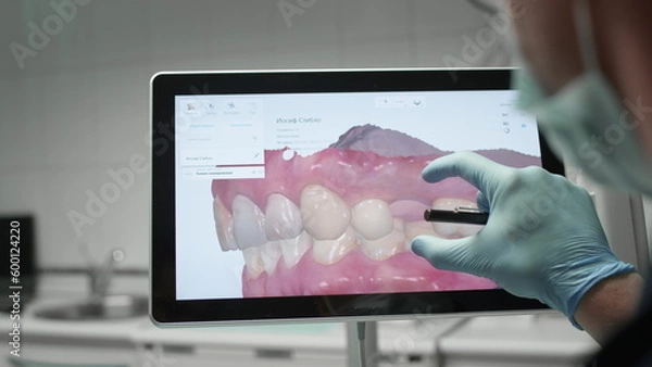 Fototapeta A professional dentist man looks at a 3d model of teeth on a computer monitor. Dental consultation, diagnostics. Jaw scan, digital imprint, medical digital technology