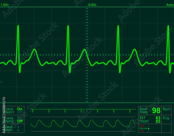 Fototapeta heart monitor screen with normal beat signal