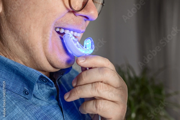 Fototapeta an aged man is engaged in teeth whitening at home using a mouth guard with an LED lamp, a snow-white smile, dental care, dentistry