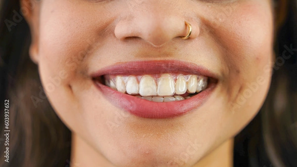 Fototapeta Young Asian Indian woman holding removable invisible aligner, also known as invisalign or  clear aligner