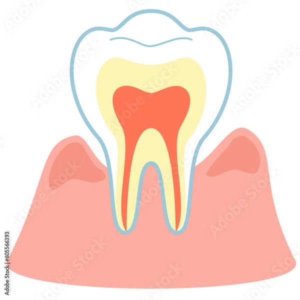 Fototapeta 歯周ポケットの空いた歯