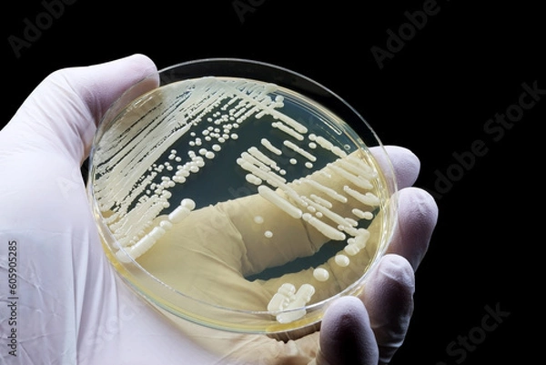 Fototapeta Hand of doctor or scientist showing a microbiological culture of the yeast Candida auris, responsible for urinary tract infections (UTIs)