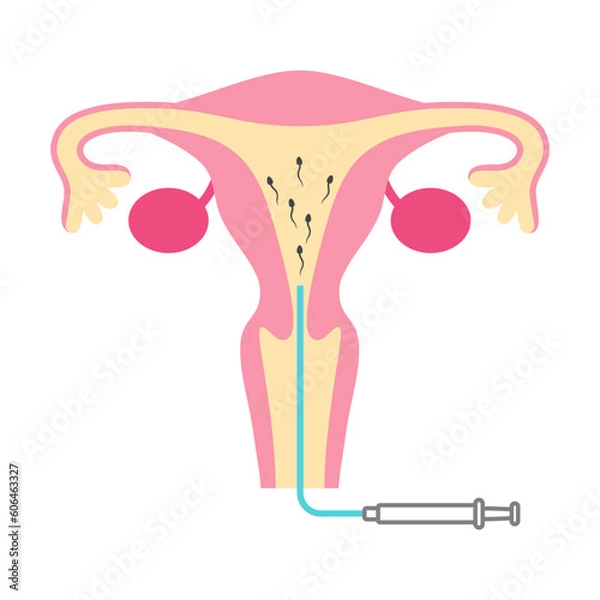 Obraz 人工授精のイラスト