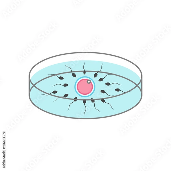 Obraz 体外受精のイラスト