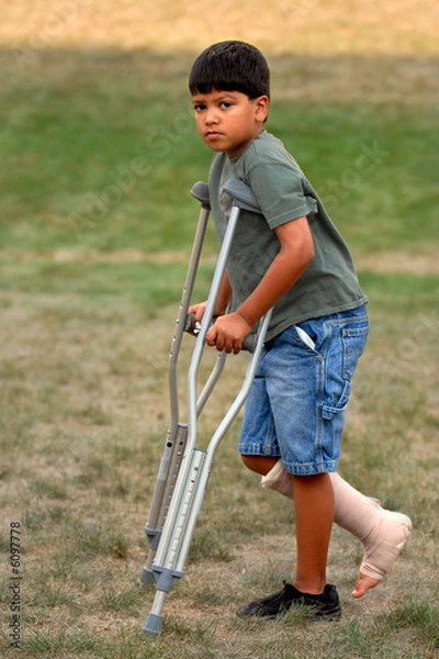 Obraz Crutches Aren't Fun!