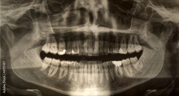 Obraz Dental x-ray