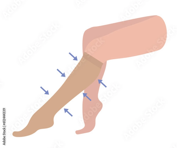 Fototapeta Women's Knee-high compression stockings. Medical underwear for female legs and feet. Specialized hosiery for varicose veins with pain and swelling. Vector illustration for medicine.