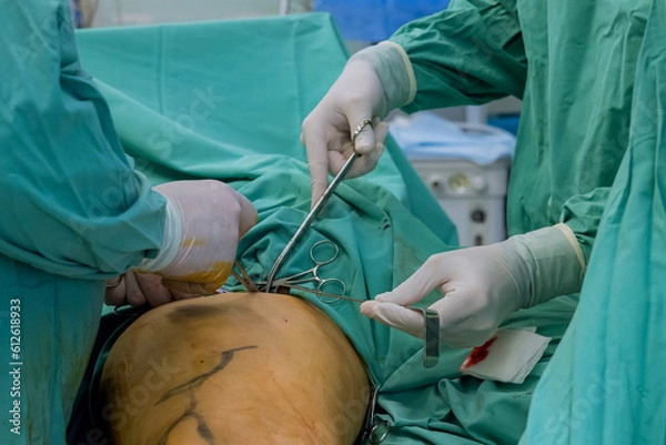 Fototapeta Doctors perform surgery on leg is orthopedic operation after suffering injuries