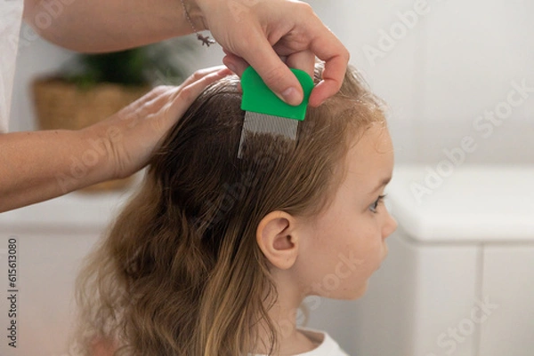 Fototapeta A woman helps to get rid of lice and parasites on the head of a little girl, combs her head with a special comb. Treatment of lice and nits