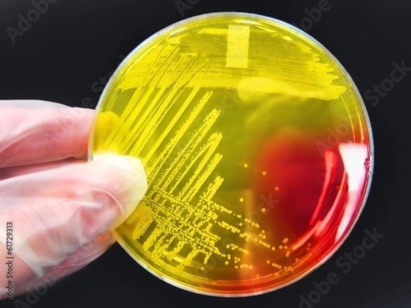 Obraz Bacterial pathogen colony on agar streak plate science lab