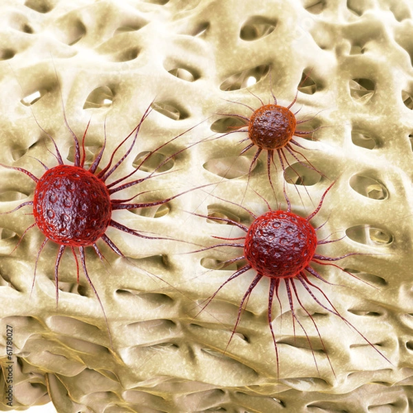 Obraz Krebs zellen - 3d Render