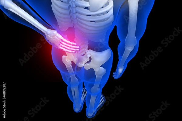 Fototapeta 3d rendered illustration - backache