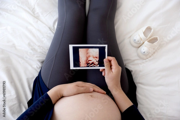 Obraz 입체초음파사진을 들고 침대에 앉아있는 임산부