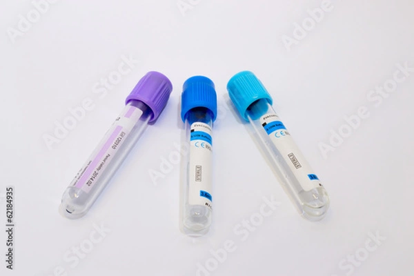 Obraz test-tube