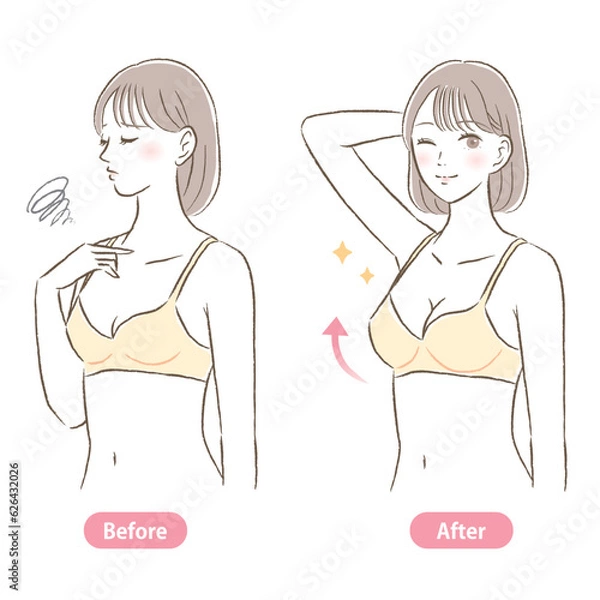 Obraz バストサイズが小さい→大きい若い女性のイラスト　ビフォーアフター
