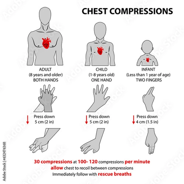 Obraz CPR chest compression