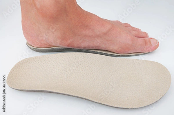 Obraz Flat feet correction. Boy's leg on orthopedic insole.