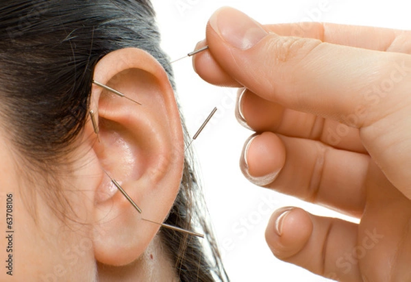 Obraz acupuncture