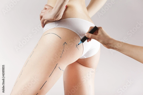 Fototapeta Female body with the drawing arrows on it isolated on white. Fat