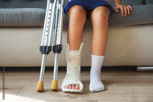 Fototapeta Child with a cast leg and crutches sitting on the sofa
