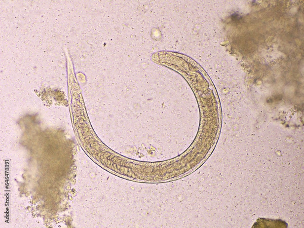 Fototapeta Strongyloides stercoralis or threadworm in human stool, analyze by microscope, original magnification 400x