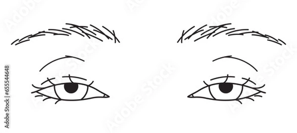 Obraz 目元　眼瞼下垂　白黒
